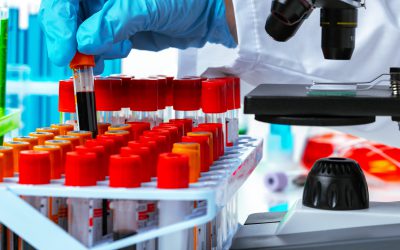 Prof. Sengupta highlighted that his team developed a cost-effective, scalable tool for early cancer detection, designed to work efficiently even in areas with minimal healthcare resources.