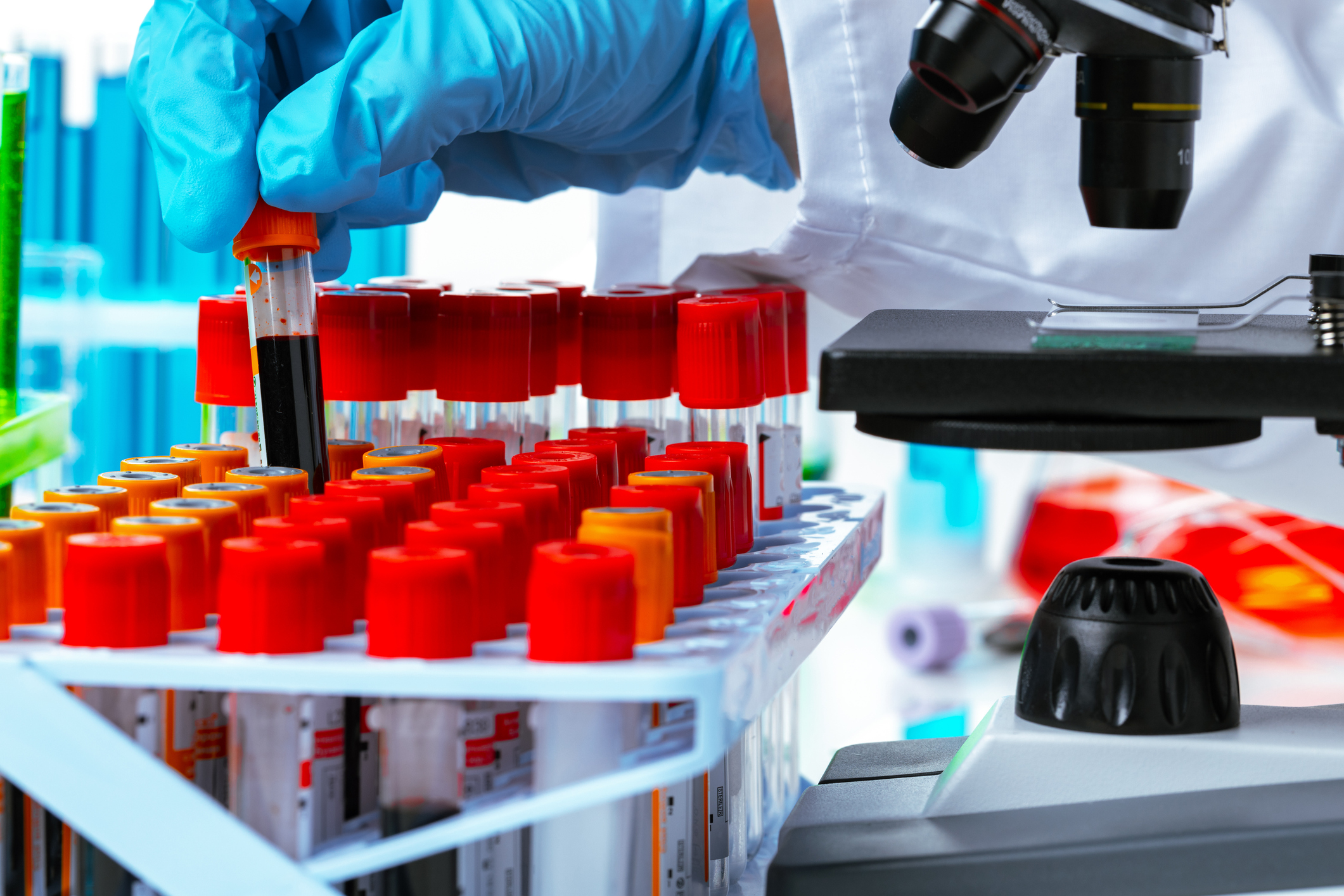 Prof. Sengupta highlighted that his team developed a cost-effective, scalable tool for early cancer detection, designed to work efficiently even in areas with minimal healthcare resources.